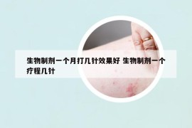生物制劑一個(gè)月打幾針效果好 生物制劑一個(gè)療程幾針