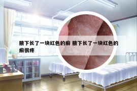 腋下長了一塊紅色的癬 腋下長了一塊紅色的癬很疼