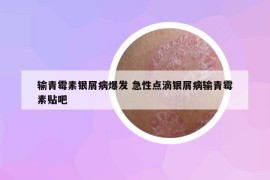 輸青霉素銀屑病爆發(fā) 急性點(diǎn)滴銀屑病輸青霉素貼吧