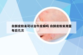 白鮮皮粉未可以治牛皮癬嗎 白鮮皮粉末用量每日幾次
