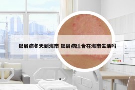 銀屑病冬天到海南 銀屑病適合在海南生活嗎