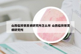 山西臨猗銀屑病研究所怎么樣 山西臨猗銀霄病研究所