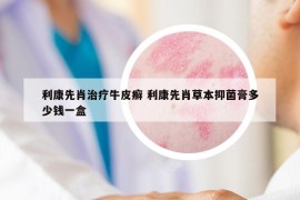 利康先肖治療牛皮癬 利康先肖草本抑菌膏多少錢一盒