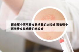 西安那個醫(yī)院看皮膚病看的比較好 西安哪個醫(yī)院看皮膚病看的比較好