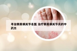 尋治銀屑病關節(jié)名醫(yī) 治療銀屑病關節(jié)炎的中藥方