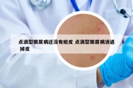 點滴型銀屑病還沒有蛻皮 點滴型銀屑病消退 掉皮