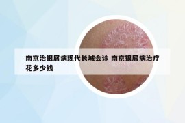 南京治銀屑病現(xiàn)代長城會診 南京銀屑病治療花多少錢