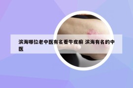濱海哪位老中醫(yī)有名看牛皮癬 濱海有名的中醫(yī)