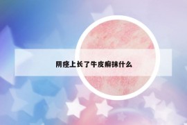 陰痙上長(zhǎng)了牛皮癬抹什么