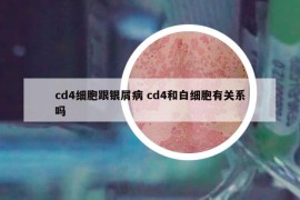 cd4細(xì)胞跟銀屑病 cd4和白細(xì)胞有關(guān)系嗎