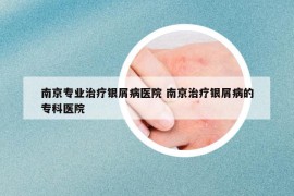 南京專業(yè)治療銀屑病醫(yī)院 南京治療銀屑病的專科醫(yī)院