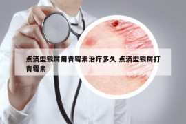 點(diǎn)滴型銀屑用青霉素治療多久 點(diǎn)滴型銀屑打青霉素