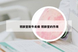 初膚堂新牛皮癬 初膚堂的作用