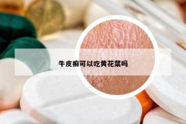 牛皮癬可以吃黃花菜嗎