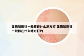 生物制劑針一般都在什么地方打 生物制劑針一般都在什么地方打的
