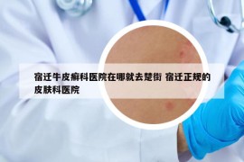 宿遷牛皮癬科醫(yī)院在哪就去楚街 宿遷正規(guī)的皮膚科醫(yī)院