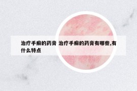 治療手癬的藥膏 治療手癬的藥膏有哪些,有什么特點(diǎn)