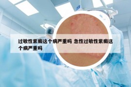 過敏性紫癜這個病嚴重嗎 急性過敏性紫癜這個病嚴重嗎