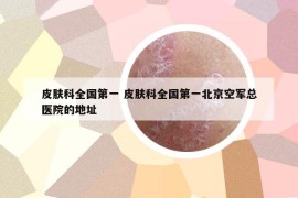 皮膚科全國(guó)第一 皮膚科全國(guó)第一北京空軍總醫(yī)院的地址