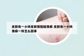 皮膚有一小塊皮膚很粗糙像癬 皮膚有一小塊像癬一樣怎么回事
