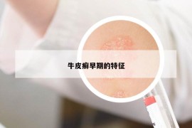 牛皮癬早期的特征
