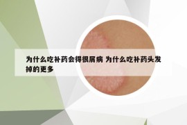 為什么吃補藥會得很屑病 為什么吃補藥頭發(fā)掉的更多