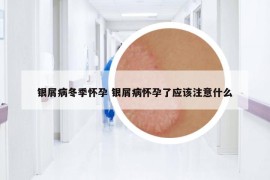 銀屑病冬季懷孕 銀屑病懷孕了應(yīng)該注意什么