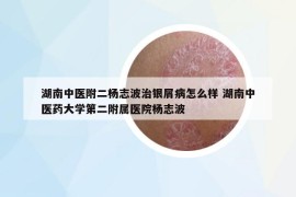 湖南中醫(yī)附二楊志波治銀屑病怎么樣 湖南中醫(yī)藥大學(xué)第二附屬醫(yī)院楊志波