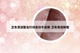 衛(wèi)生清潔整治行動首日牛皮癬 衛(wèi)生清潔制度