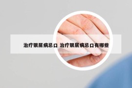 治療銀屑病忌口 治療銀屑病忌口有哪些
