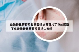 鹽酸特比萘芬片和鹽酸特比萘芬片丁克的區(qū)別 丁克鹽酸特比萘芬片是抗生素嗎