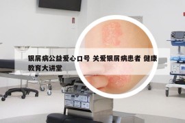 銀屑病公益愛心口號 關(guān)愛銀屑病患者 健康教育大講堂