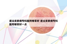 遵義皮膚病專科醫(yī)院哪家好 遵義皮膚病?？漆t(yī)院哪家好一點(diǎn)