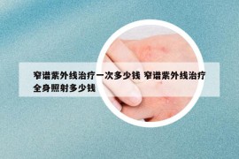 窄譜紫外線治療一次多少錢 窄譜紫外線治療全身照射多少錢