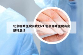 北京哪家醫(yī)院有皮膚ct 北京哪家醫(yī)院有皮膚科急診