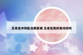 王老吉沖劑能治銀屑病 王老吉真的有功效嗎