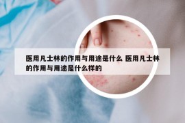 醫(yī)用凡士林的作用與用途是什么 醫(yī)用凡士林的作用與用途是什么樣的