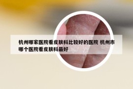 杭州哪家醫(yī)院看皮膚科比較好的醫(yī)院 杭州市哪個(gè)醫(yī)院看皮膚科最好
