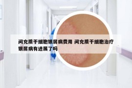間充質(zhì)干細胞銀屑病費用 間充質(zhì)干細胞治療銀屑病有進展了嗎