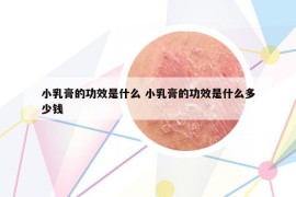 小乳膏的功效是什么 小乳膏的功效是什么多少錢