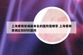 上?？淬y屑病最有名的醫(yī)院是哪家 上海看銀屑病比較好的醫(yī)院
