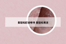 氟輕松酊說明書 氟輕松用法