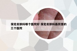 保定皮膚科哪個醫(yī)院好 保定皮膚科最厲害的三個醫(yī)院