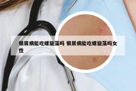 銀屑病能吃螺旋藻嗎 銀屑病能吃螺旋藻嗎女性