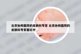 北京協(xié)和醫(yī)院的皮膚科專家 北京協(xié)和醫(yī)院的皮膚科專家晉紅中