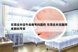 石家莊長征牛皮癬?？漆t(yī)院 石家莊長征醫(yī)院皮膚科專家