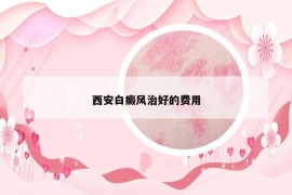 西安白癜風(fēng)治好的費(fèi)用