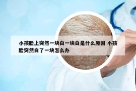 小孩臉上突然一塊白一塊白是什么原因 小孩臉突然白了一塊怎么辦