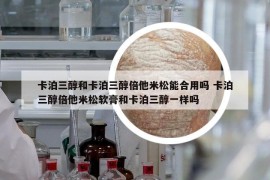 卡泊三醇和卡泊三醇倍他米松能合用嗎 卡泊三醇倍他米松軟膏和卡泊三醇一樣嗎