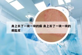 身上長了一塊一塊的癬 身上長了一塊一塊的癬起皮